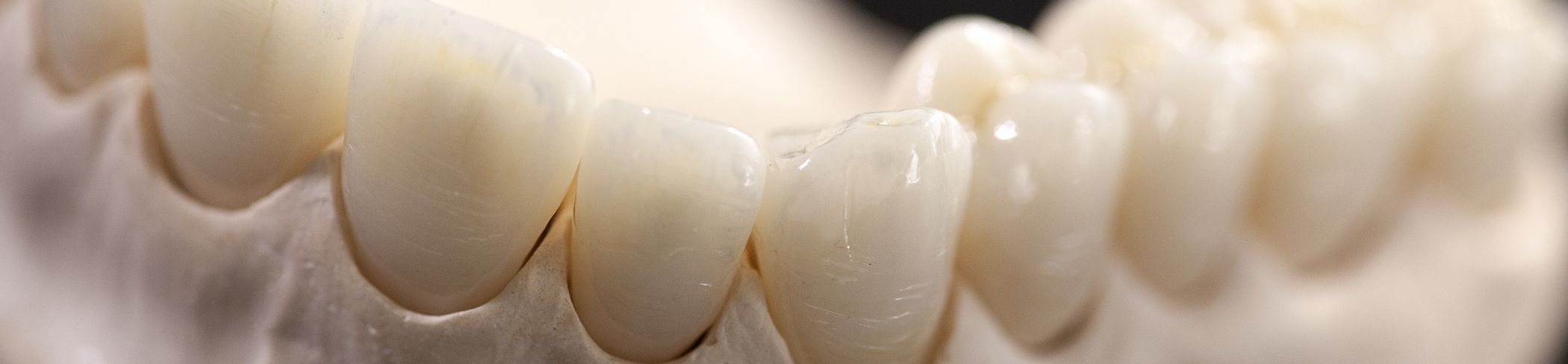graphenano-dental-2